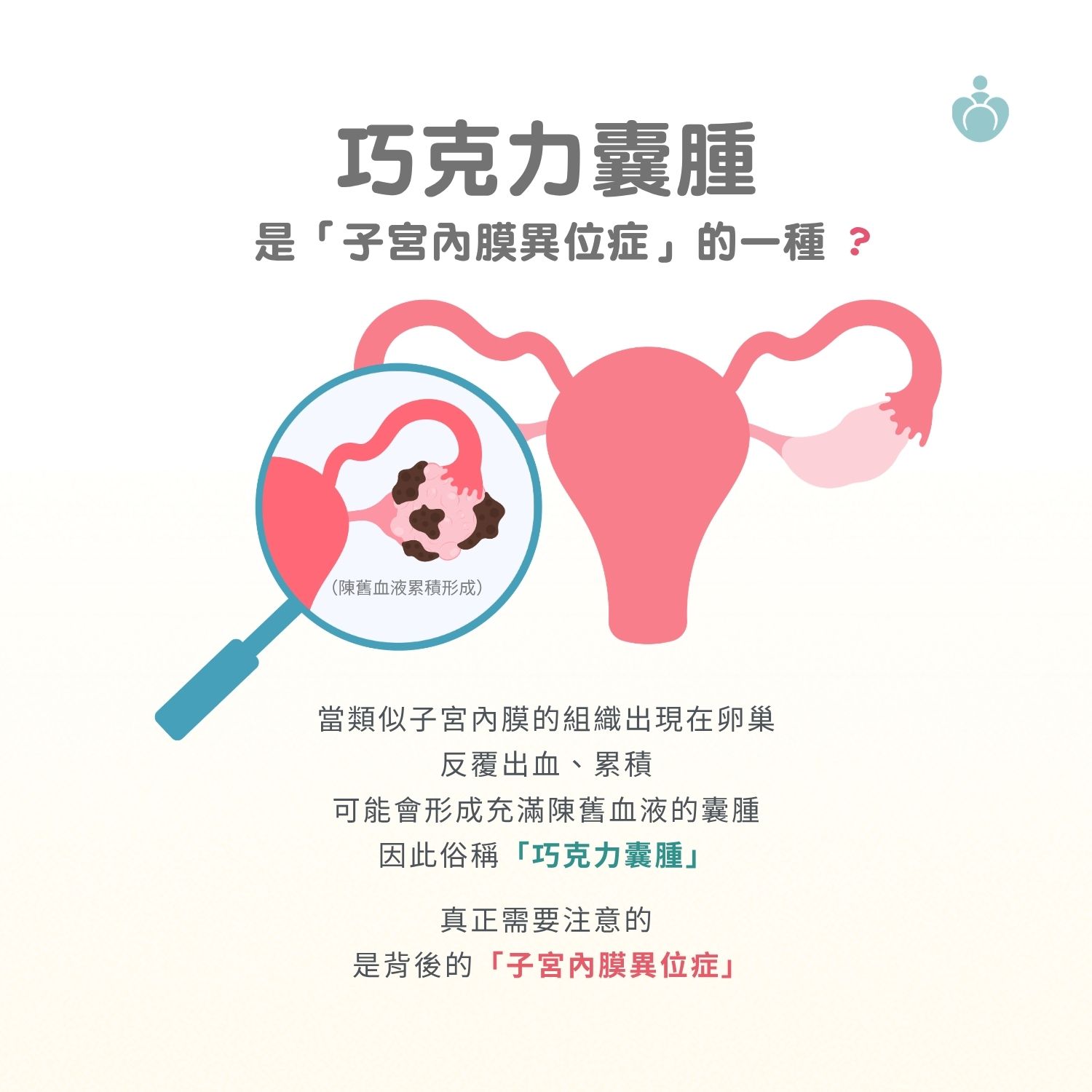 巧克力囊腫衛教圖片